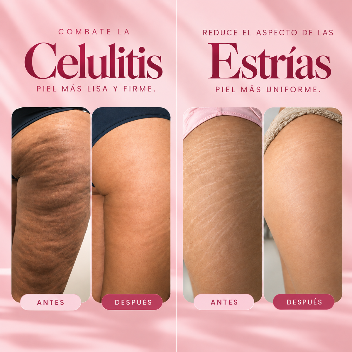 Crema Reductora de Estrías y Celulitis CANDELA
