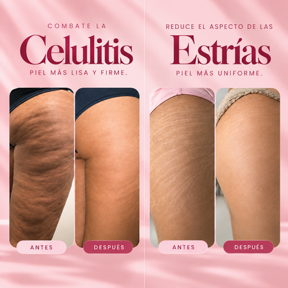 Crema Reductora de Estrías y Celulitis CANDELA